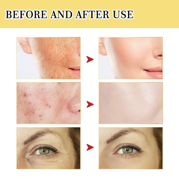 Snail Serum Collagen Facial Serum Original My Store
