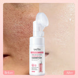 Hyaluronic Acid Amino Acid Cleansing Mousse My Store