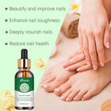 Onychomycosis Repair Essence Hand And Foot Nutrition My Store