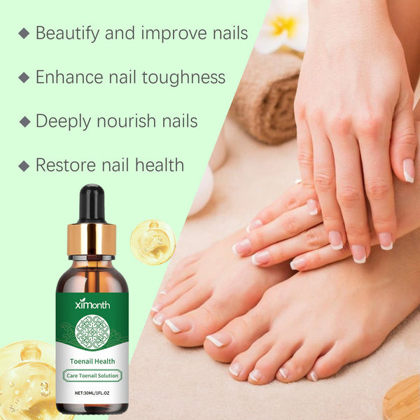 Onychomycosis Repair Essence Hand And Foot Nutrition My Store